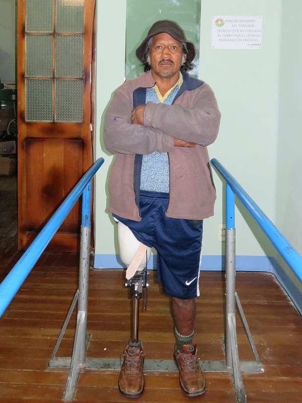 Javier standing on his new prosthetic leg with LIMBS polycentric knee and Shape and Roll SACH foot.